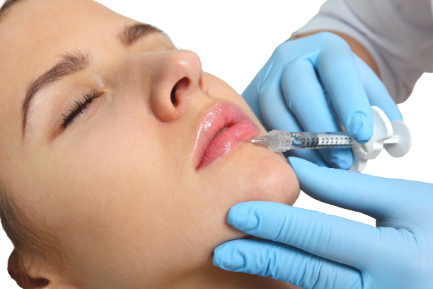 Lippenbehandlung mit Hyaluronsäure